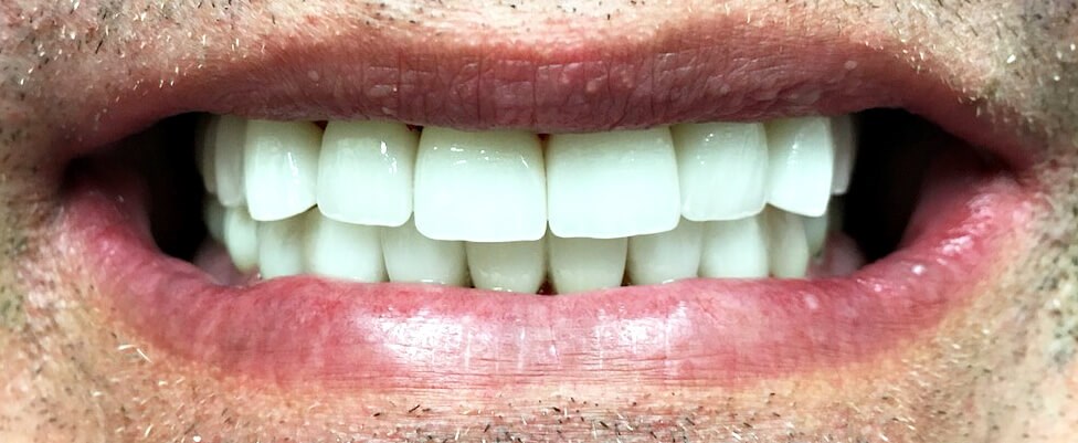 Captivating Smile After