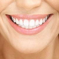 Fluoride Treatment