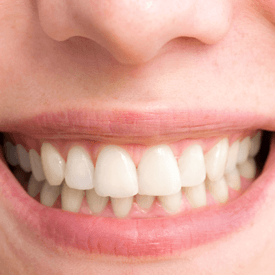 Periodontal Treatments Image